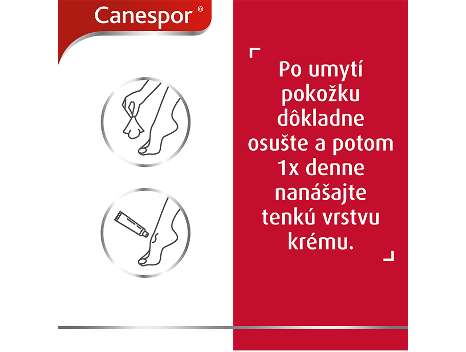 Canespor krém - aplikácia